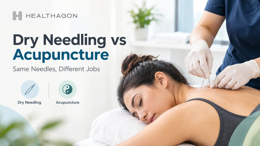 Dry Needling vs Acupuncture: article image