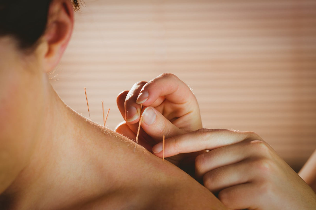 Dry needling care at Healthagon
