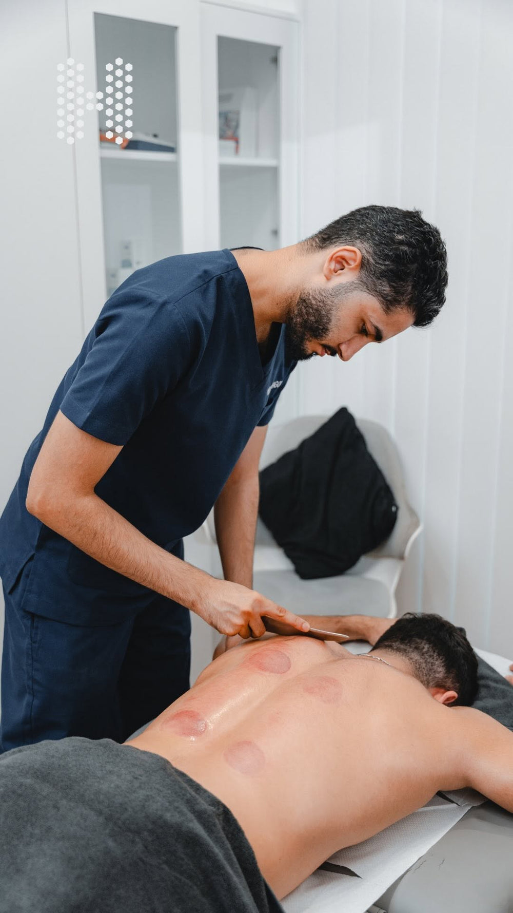 Dry cupping therapy Instagram video