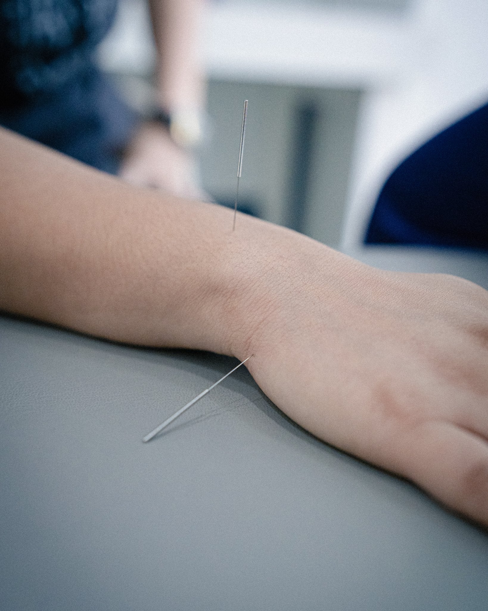 Exploring How Dry Needling Works